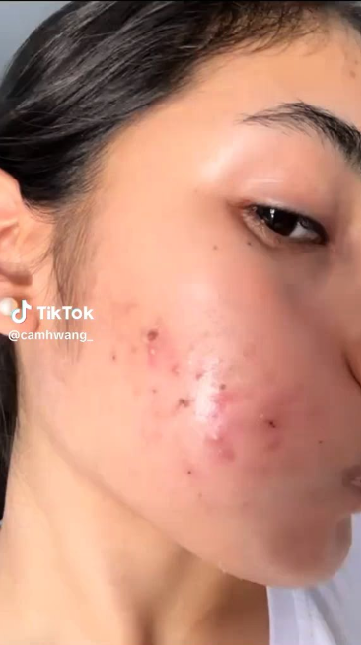 Video 4