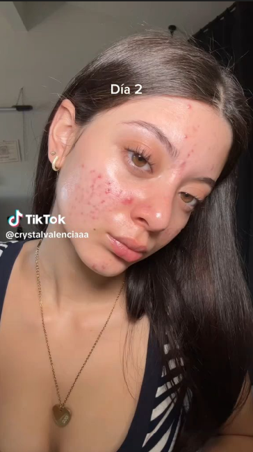 Video 1